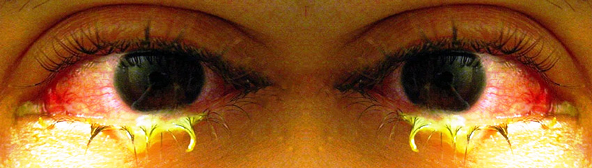 What Are Eye-Boogers and What Causes Them? eye booogers what are they 1 - What Are Eye-Boogers and What Causes Them?