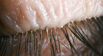 Eyelash Extensions and Lash Mites – What You Need To Know ASAP