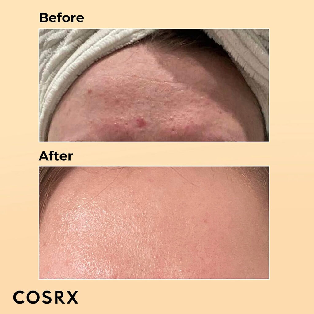 COSRX Snail Mucin Before and After